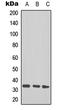 Talin 1 antibody, LS-C368622, Lifespan Biosciences, Western Blot image 