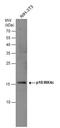 Cyclin Dependent Kinase Inhibitor 2C antibody, GTX130798, GeneTex, Western Blot image 