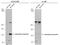 Adenylate Cyclase 5 antibody, PA5-77847, Invitrogen Antibodies, Western Blot image 