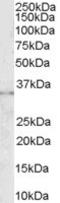 Fc Fragment Of IgG Receptor IIb antibody, TA302446, Origene, Western Blot image 