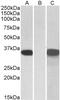 Aconitase 2 antibody, 42-526, ProSci, Immunohistochemistry paraffin image 