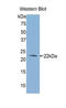 Aldehyde Dehydrogenase 1 Family Member A3 antibody, LS-B15010, Lifespan Biosciences, Western Blot image 