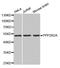 Protein Phosphatase 2 Regulatory Subunit Balpha antibody, A13530, ABclonal Technology, Western Blot image 