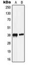 Leucine Rich Alpha-2-Glycoprotein 1 antibody, LS-C353622, Lifespan Biosciences, Western Blot image 
