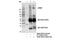Leucine Rich Repeat Kinase 2 antibody, 13046S, Cell Signaling Technology, Immunoprecipitation image 