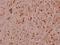 Heat Shock Protein Family B (Small) Member 1 antibody, A00676S82-1, Boster Biological Technology, Immunohistochemistry frozen image 