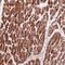 ADP-Ribosyltransferase 5 antibody, PA5-60610, Invitrogen Antibodies, Immunohistochemistry paraffin image 