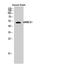 Armadillo Repeat Containing X-Linked 1 antibody, STJ91696, St John