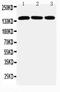 Ataxin 2 antibody, PA2098, Boster Biological Technology, Western Blot image 