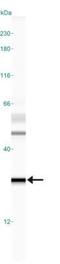 O-6-Methylguanine-DNA Methyltransferase antibody, GTX27045, GeneTex, Western Blot image 