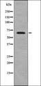 NUAK Family Kinase 1 antibody, orb335843, Biorbyt, Western Blot image 