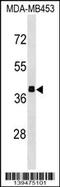 Aldolase, Fructose-Bisphosphate B antibody, 60-153, ProSci, Western Blot image 