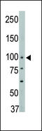 Protein Tyrosine Phosphatase Non-Receptor Type 3 antibody, 63-464, ProSci, Western Blot image 