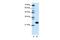 Ribosomal Protein L13 antibody, GTX47430, GeneTex, Western Blot image 