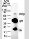 Inhibitor Of Nuclear Factor Kappa B Kinase Subunit Beta antibody, NB100-56513, Novus Biologicals, Western Blot image 