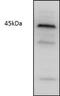 Cyclin Dependent Kinase 9 antibody, PA1-84581, Invitrogen Antibodies, Western Blot image 