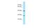 Myozenin 3 antibody, A13181, Boster Biological Technology, Western Blot image 