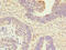 ANTXR Cell Adhesion Molecule 2 antibody, LS-C675380, Lifespan Biosciences, Immunohistochemistry paraffin image 