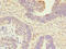 Anthrax toxin receptor 2 antibody, LS-C675380, Lifespan Biosciences, Immunohistochemistry paraffin image 