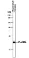 Phospholipase A2, membrane associated antibody, PA5-47672, Invitrogen Antibodies, Western Blot image 