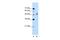 Ring Finger Protein 38 antibody, A05526, Boster Biological Technology, Western Blot image 