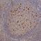 TNF Receptor Superfamily Member 8 antibody, MAB2291, R&D Systems, Immunohistochemistry frozen image 