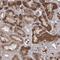 Pleckstrin Homology Domain Containing A5 antibody, PA5-57464, Invitrogen Antibodies, Immunohistochemistry paraffin image 