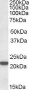 Proteasome Subunit Beta 8 antibody, MBS421670, MyBioSource, Western Blot image 