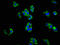 Integrin Subunit Alpha 1 antibody, LS-C670486, Lifespan Biosciences, Immunofluorescence image 