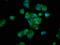 Hydroxyacid Oxidase 1 antibody, LS-C672437, Lifespan Biosciences, Immunofluorescence image 