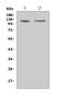 Discoidin Domain Receptor Tyrosine Kinase 2 antibody, A01698-1, Boster Biological Technology, Western Blot image 