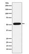 Chromobox 4 antibody, M03388, Boster Biological Technology, Western Blot image 