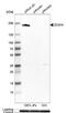 Zinc Finger CCCH-Type Containing 4 antibody, NBP1-88475, Novus Biologicals, Western Blot image 