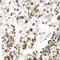 Staphylococcal Nuclease And Tudor Domain Containing 1 antibody, 19-910, ProSci, Immunohistochemistry paraffin image 