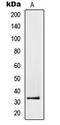 Prostate Transmembrane Protein, Androgen Induced 1 antibody, GTX55966, GeneTex, Western Blot image 