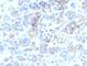 Tyrosinase Related Protein 1 antibody, V2916IHC-7ML, NSJ Bioreagents, Immunohistochemistry paraffin image 