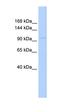 Collagen Type VI Alpha 1 Chain antibody, orb333719, Biorbyt, Western Blot image 