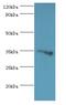 Glycine-N-Acyltransferase Like 1 antibody, MBS1494200, MyBioSource, Western Blot image 