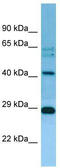 Mitochondrial Ribosomal Protein L38 antibody, TA343223, Origene, Western Blot image 