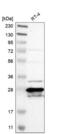 Methenyltetrahydrofolate Synthetase antibody, NBP1-83161, Novus Biologicals, Western Blot image 