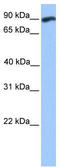 WD Repeat And FYVE Domain Containing 3 antibody, TA339826, Origene, Western Blot image 