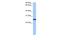 Centrosomal Protein 112 antibody, A15666, Boster Biological Technology, Western Blot image 