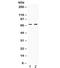 REL Proto-Oncogene, NF-KB Subunit antibody, R31972, NSJ Bioreagents, Western Blot image 