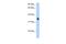 Solute Carrier Family 35 Member F2 antibody, A13770, Boster Biological Technology, Western Blot image 