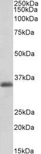 Paired Related Homeobox 1 antibody, 43-276, ProSci, Western Blot image 