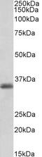 Paired mesoderm homeobox protein 1 antibody, 43-276, ProSci, Western Blot image 