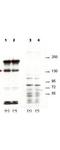 Rho Associated Coiled-Coil Containing Protein Kinase 2 antibody, NBP1-77947, Novus Biologicals, Western Blot image 