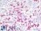 S100 Calcium Binding Protein A9 antibody, LS-B9953, Lifespan Biosciences, Immunohistochemistry frozen image 
