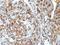 Mucin 1, Cell Surface Associated antibody, NBP2-48375, Novus Biologicals, Immunohistochemistry paraffin image 