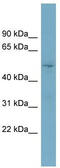 Target Of Myb1 Like 2 Membrane Trafficking Protein antibody, TA339987, Origene, Western Blot image 